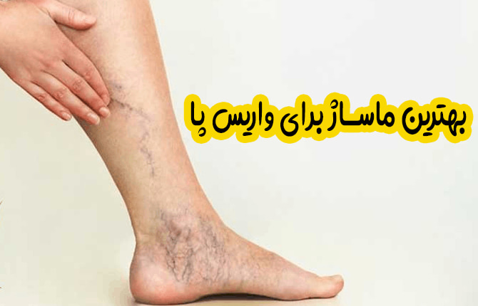 بهترین ماساژ برای واریس پا